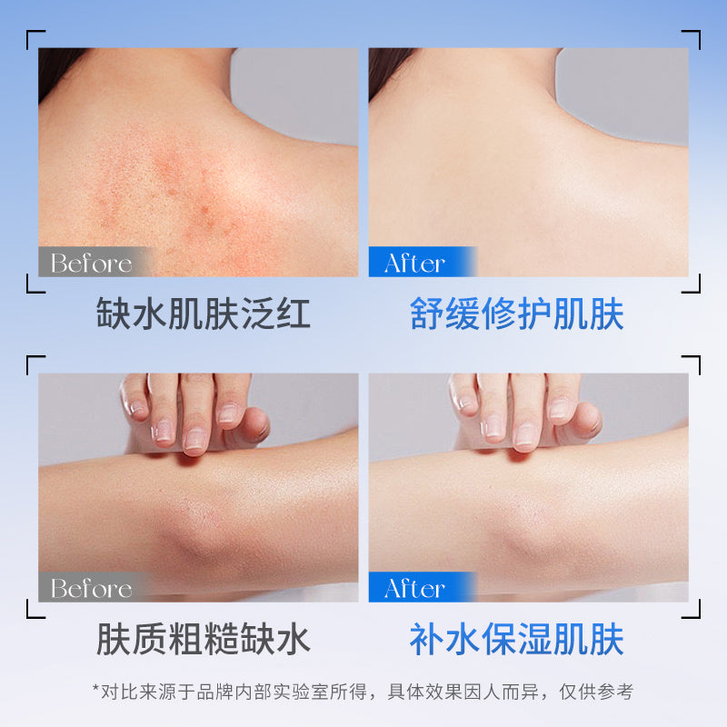 HYMEY'S HA+B5 Vitamin Panthenol Hyaluronic Acid Silky Moisturizing Body Lotion